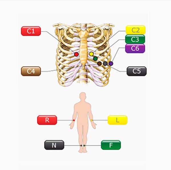 EDAN Express/SE-1201 ЭКГ - 12-канальный электрокардиограф 