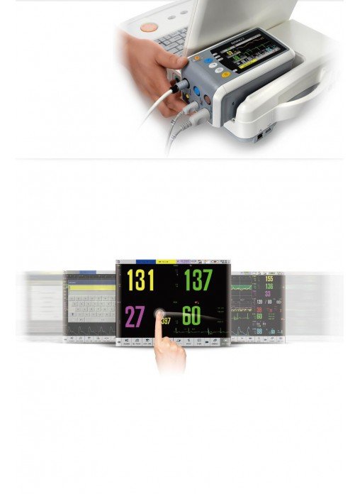 Comen C20 Фетальный монитор