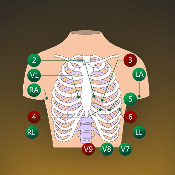 EDAN SE-18  18-канальный кардиограф ЭКГ 